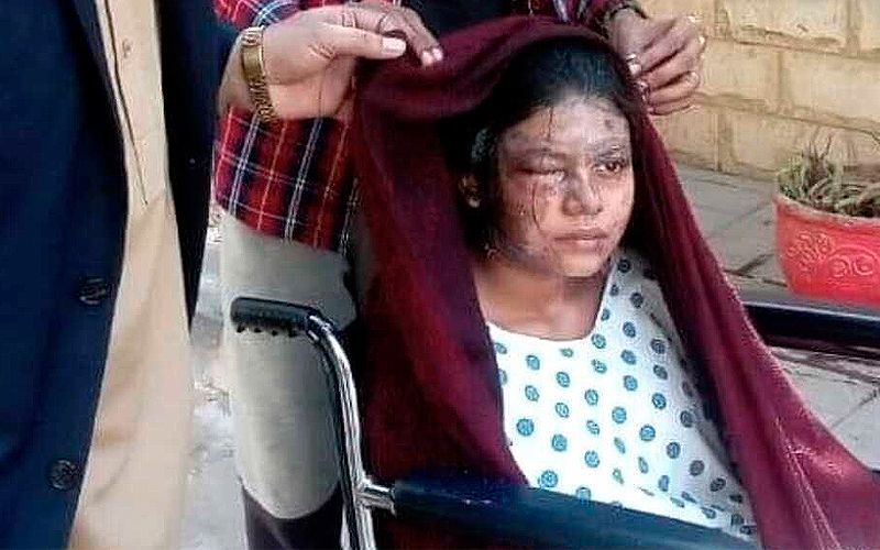 PAKISTÁN: FUE BAÑADA CON ÁCIDO POR NO NEGAR SU FE